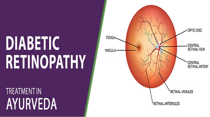 Diabetic Retinopathy Treatment